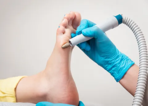 A gloved hand uses an electric pedicure tool on the sole of a person’s foot, focusing on callus or dead skin removal during a professional foot care treatment.